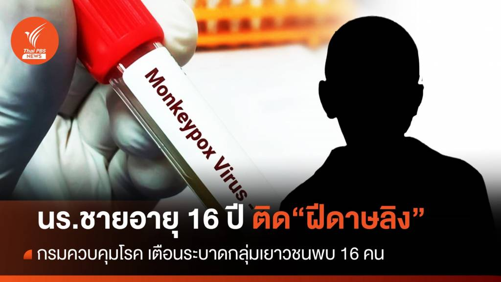 与多人发生性关系，16岁泰国男孩感染猴痘